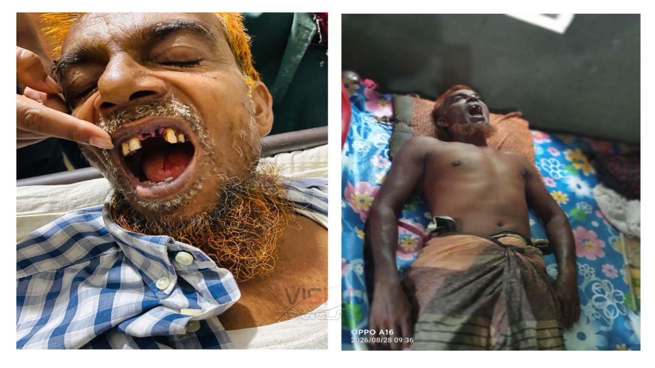 জমি নিয়ে বিরোধের জেরে হামলার অভিযোগ