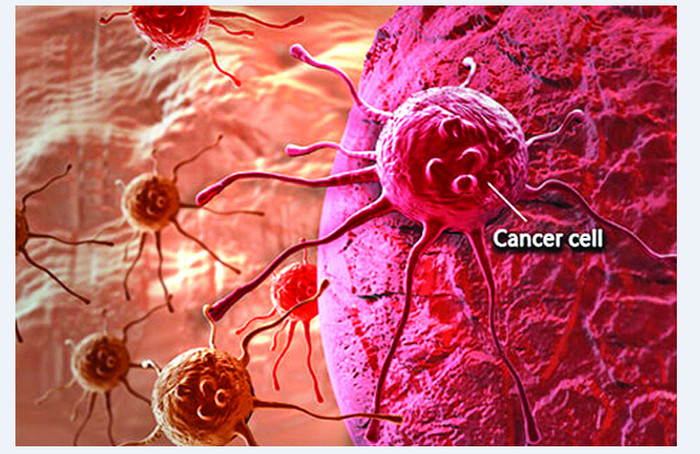 মানব দেহে নীরবে বাসা বাঁধে যেসব ক্যান্সার