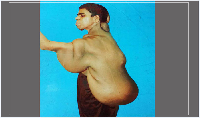 দেলোয়ারের শরীর জুড়ে এ কেমন বোঝা!