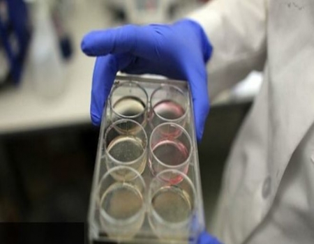 লিভার চিকিৎসায় বাংলাদেশী চিকিৎসকদের উদ্ভাবন