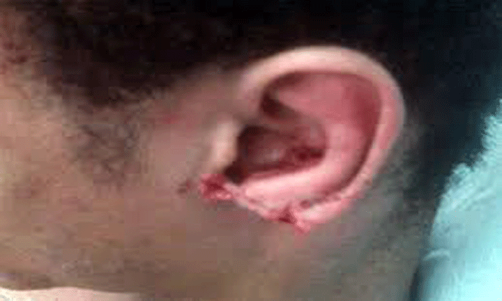 সিরাজগঞ্জে টাকা ফেরত না দেয়ায় যুবকের কান কর্তন