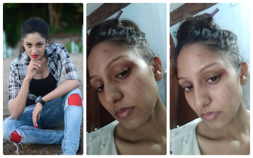 পরকীয়া প্রেমিকের স্ত্রী-কন্যার মারধরের শিকার চিত্রনায়িকা রাকা