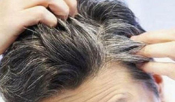 আপনার কি চুল পেকে যাচ্ছে, ঘরোয়া পদ্ধতিতে খুব সহজে প্রতিরোধ করুন