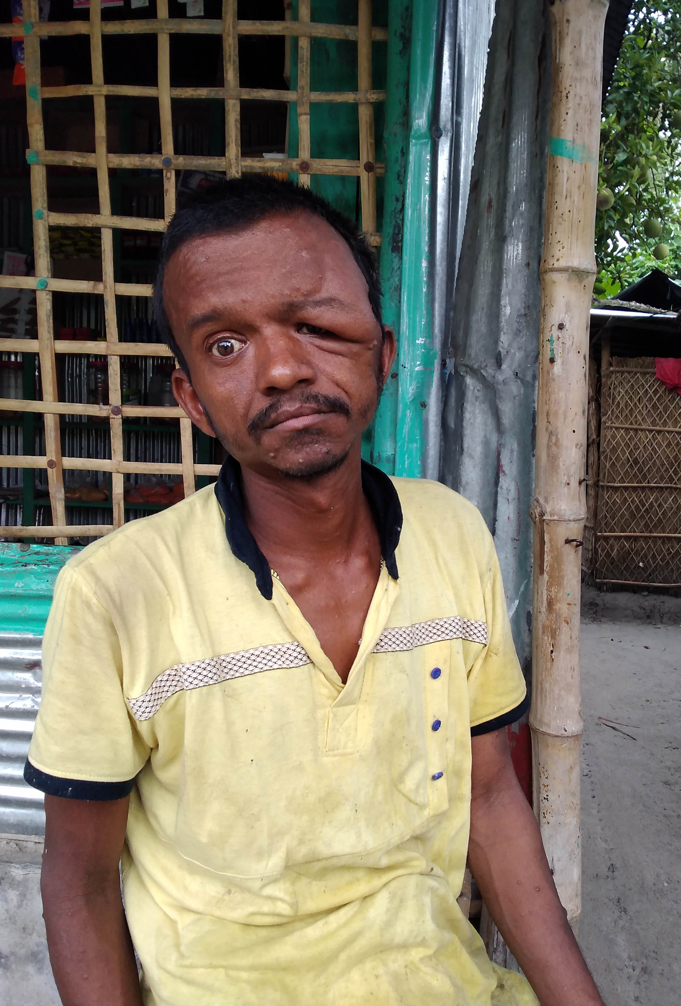 টাকার অভাবে ভ্যাগে জোটেনি প্রতিবন্ধীর ভাতা