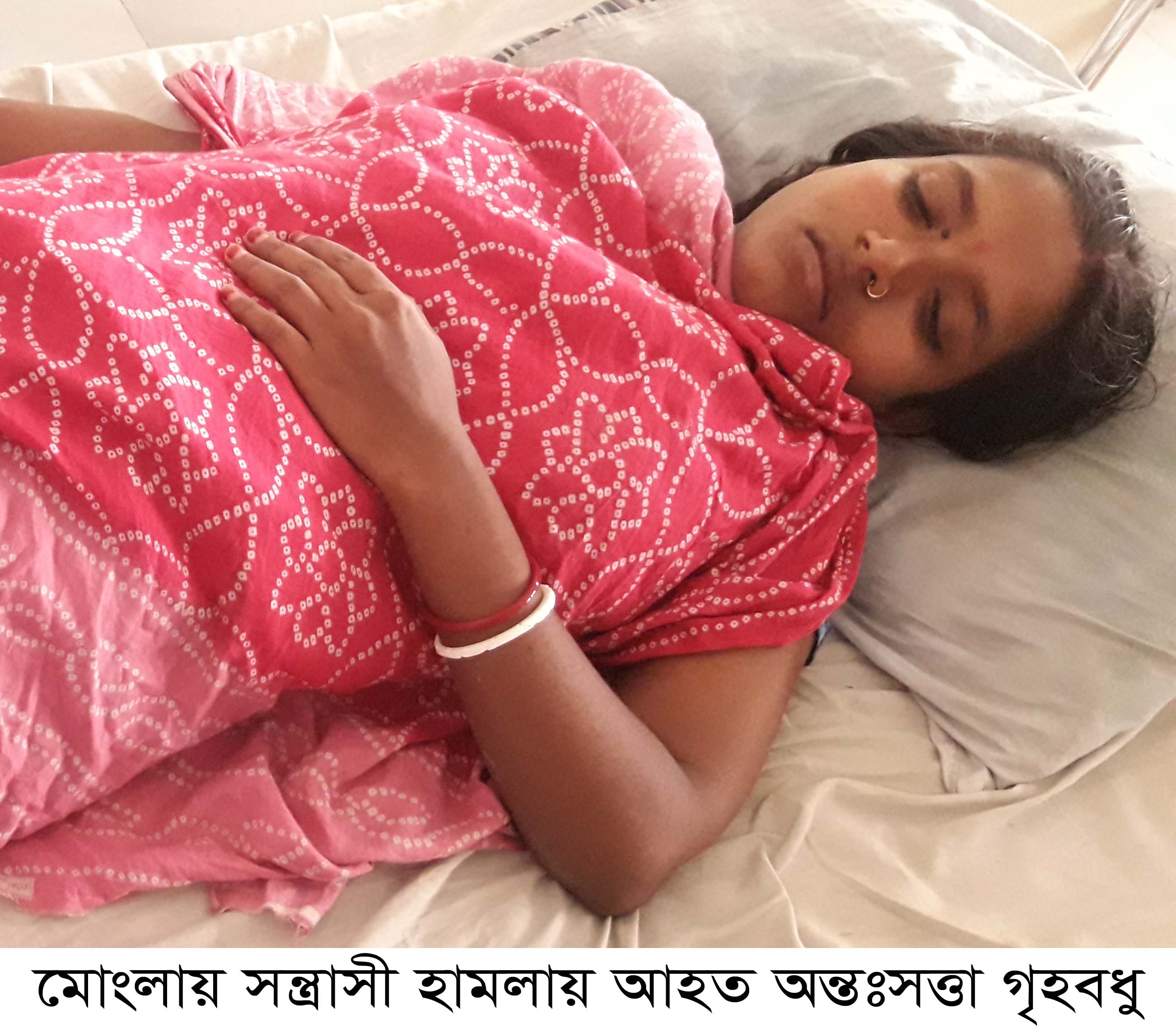 মোংলায় সংখ্যালঘু পরিবারের উপর সন্ত্রাসী হামলায় গর্ভবতী গৃহবধু ও শিশুসহ আহত-৭, থানায় অভিযোগ