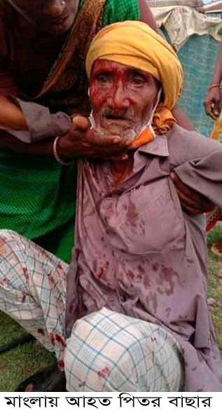 মোংলায় জমি দখলে বাধা: সন্ত্রাসীদের দায়ের কোপে বৃদ্ধসহ আহত-৪