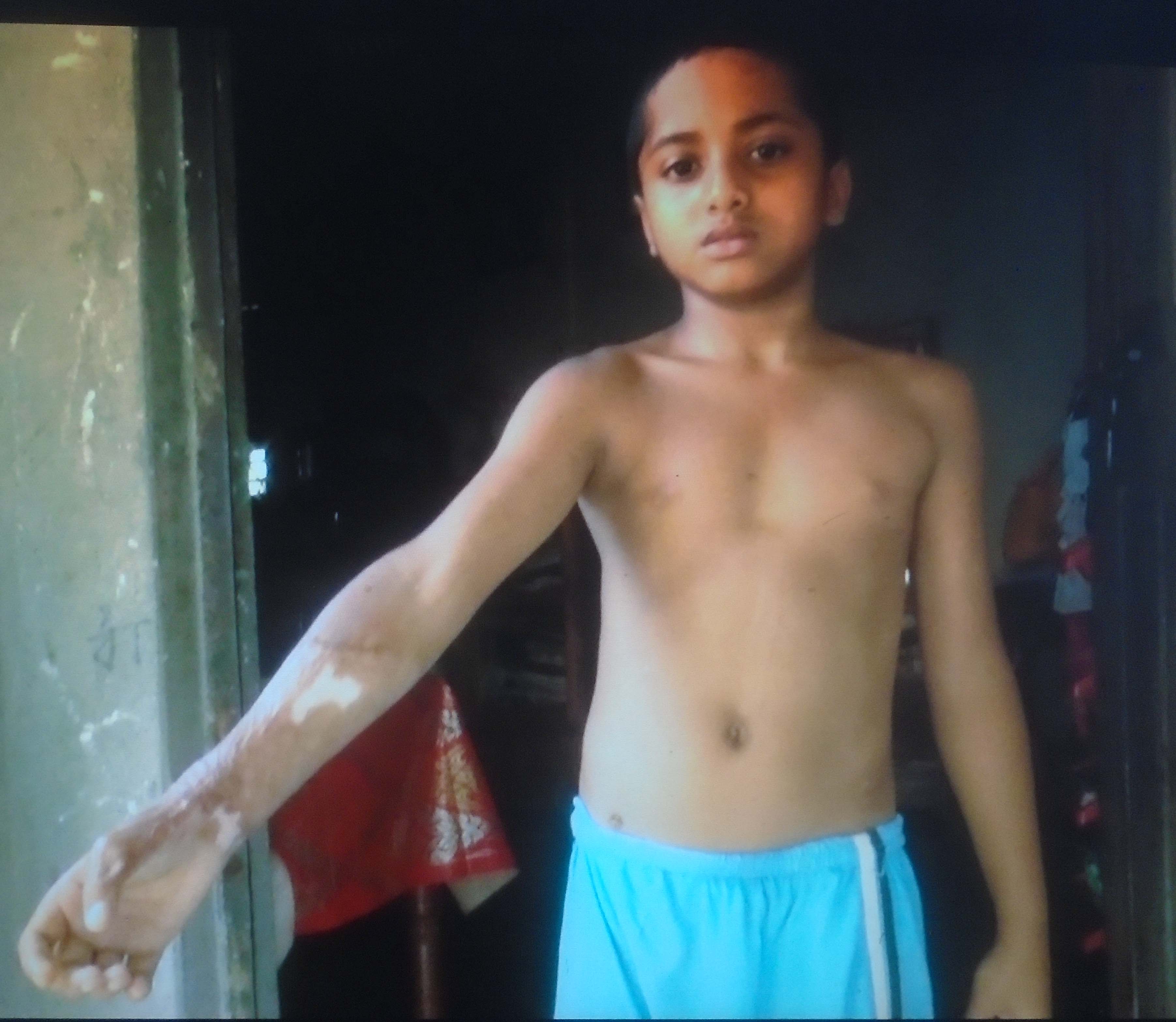 ডোমারে একই পরিবারে ২ প্রতিবন্ধী, হয়নি কোন ভাতা