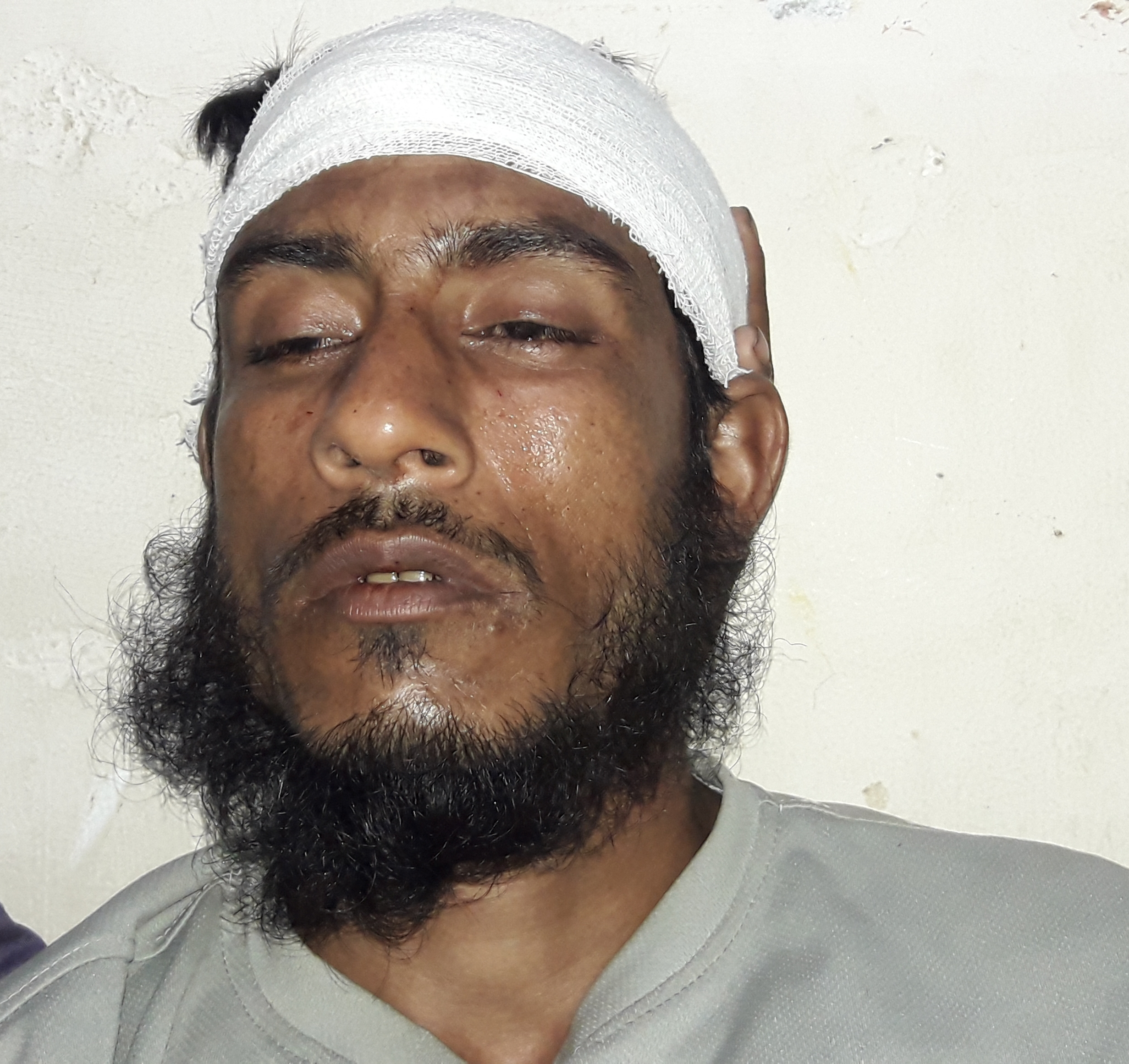 মোংলায় প্রতিপক্ষ সন্ত্রাসীদের হামলায় দুই সহদর আহত