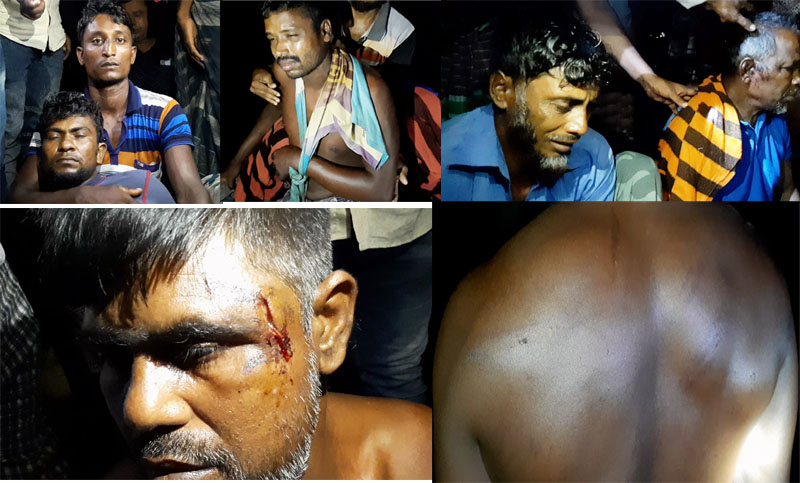 সুন্দরবনে মাছ ধরতে গিয়ে দস্যুবাহিনীর হামলা ও অমানুষিক নির্যাতনের ক্ষত নিয়ে ফিরে এসেছে মোংলার একদল জেলে