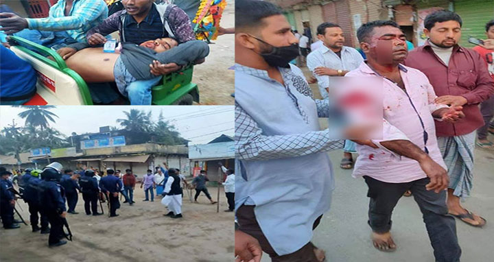 মির্জা-বাদল গ্রুপের সংঘর্ষে পুলিশের গুলি, আহত ৫০