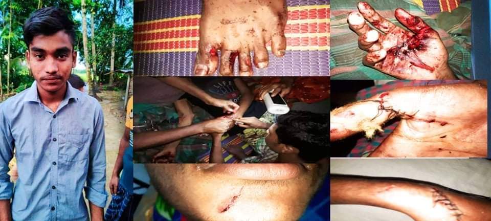 শার্শায় প্রেম ঘটিত কারণে যুবককে কুপিয়ে  হত্যা চেষ্টার অভিযোগ