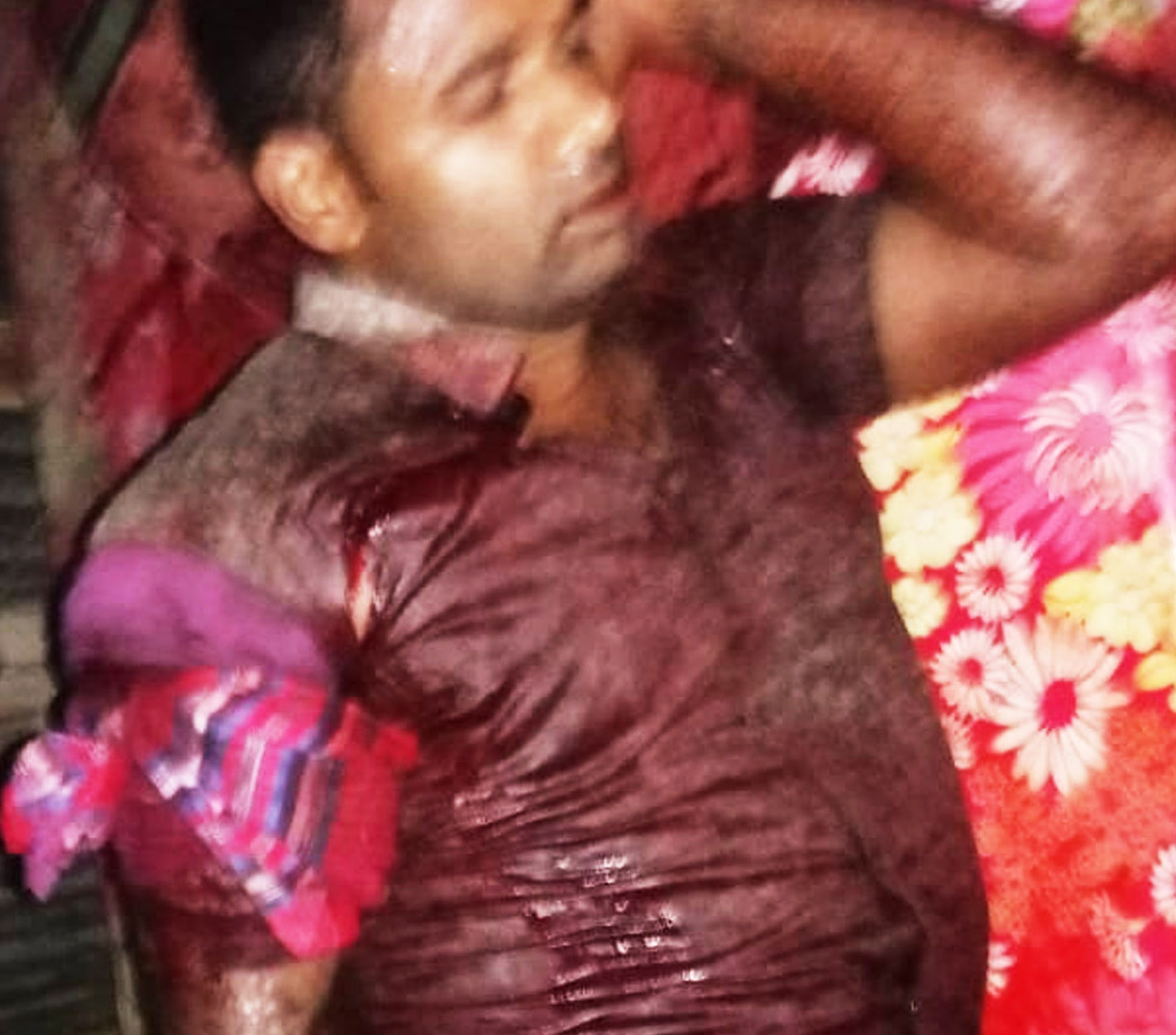 গৌরনদীতে কুপিয়ে জখম