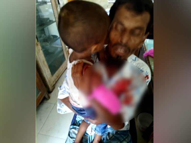 মিরপুরে চিড়িয়াখানায় শিশুর হাত ছিঁড়ে নিয়ে গেল হায়েনা