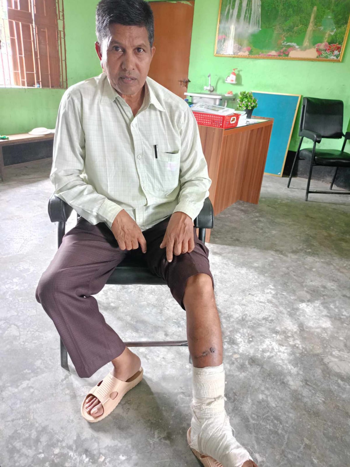 কুষ্টিয়ায় পূর্ব শত্রুতা জের ধরে বড় ভাইয়ের আঘাতে ছোট ভাই জখম