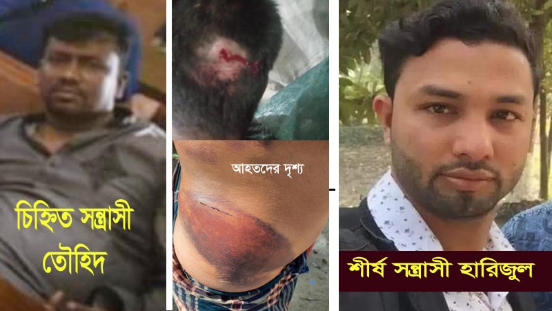 রূপগঞ্জে তৌহিদ ও হারিজুলের সন্ত্রাসী গ্রুপের হামলায় গুরুতর আহত শান্ত আহমেদ